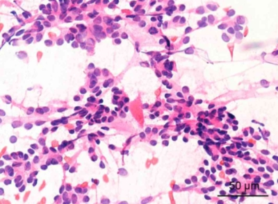 cytological examination of biological fluids and fine needle aspirates