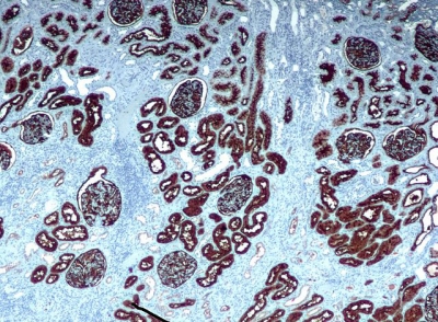 Immunohistochemical staining